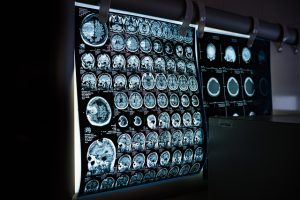 wykonanie tomografii komputerowej
